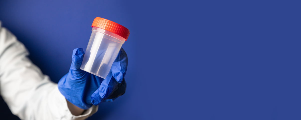A person’s hand in a blue glove holding a drug testing bottle against a blue background in El Paso.
