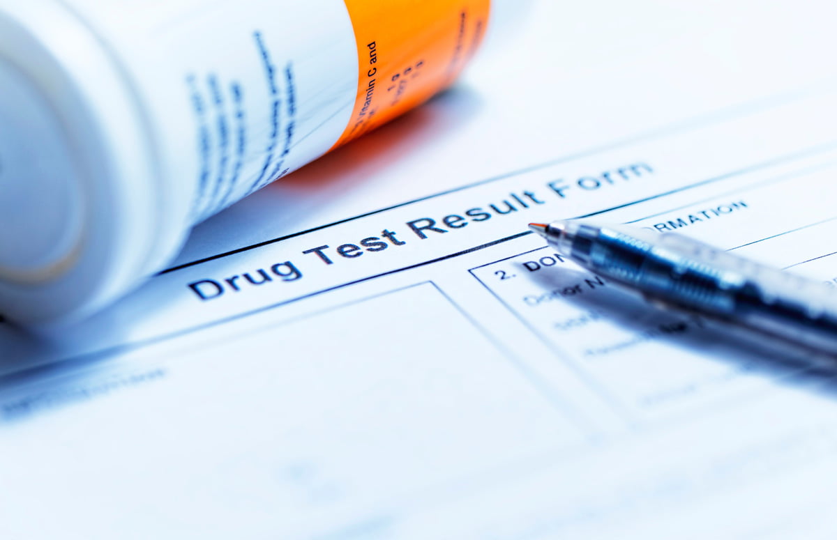 A close-up image of a piece of paper that reads “Drug Test Result Form” with a pill bottle and pen on top in El Paso.